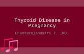 Thyroid Disease in Pregnancy.ppt