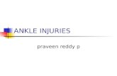 Ankle fractures