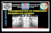 Transmigration of permanent mandibular canines