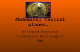 Radiological anatomy of abdominal spaces ...pathway of tumor  and infection spread