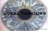Uveal tumours