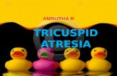 Tricuspid atresia in pediatrics