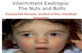 Intermittent exotropia