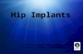 Hip implants   dr.thahir