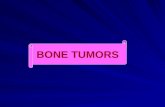 Bone Tumors Benign Ppt