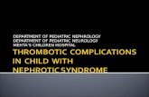 Nephrotic syn with thromboembolism
