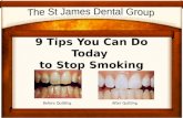 9 Steps You Can Do Today to Quit Smoking