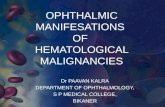 Ophthalmic Manifestations of Hematological Malignancies