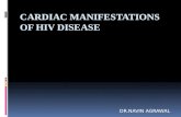 Navin presentation for hiv disease