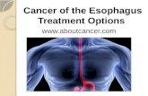 Treatment of Cancer of the Esophagus