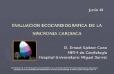 Evaluación Ecocardiográfica de la Sincronía Cardiaca