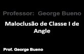 Aula - George Bueno - Maloclusão de Classe I de Angle