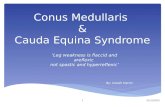 Conus medullaris and cauda equina syndrome