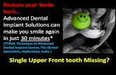Single front upper front tooth missing. Get it replaced in just 30 min* at The Dental Specialists