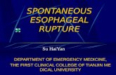 Spontaneous Esophageal Rupture  修改后