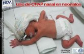 Uso de cpapn en neonatos