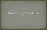 Barton’s fracture