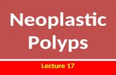 L17 neoplastic polyps