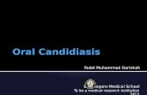 1.1 oral candidiasis