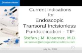 Overview of Endoscopic Gastric Fundoplication