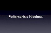 Panarteritis Nodosa