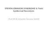 Steven johnson syndrome & ten