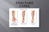 Bone Fracture Types by Nadia Abdulallah