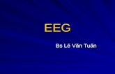 Bai Giang Dien Nao Do (EEG)