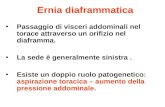 Ernia diaframmatica