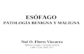 Esofago Patologia Benigna y Maligna