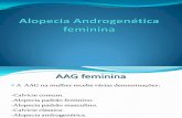 Alopecia Androgenètica feminina