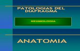 Patologias Del Diafragma Neumologia