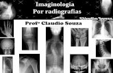 aula 5 Imaginologia por radiografias- Tornozelo, calcaneo, pe,antepe- ProfºClaudio Souza- ATUALIZADO EM 05/2012