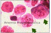 Presentacion de Anemia Megaloblastica