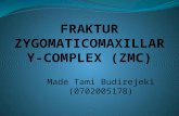 fraktur zygomaticomaxillary-complex