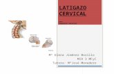 Latigazo Cervical Sesic3b3n Centro de Salud