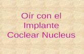 Oir con-el-implante-coclear-nucleus21