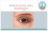 Patologia del parpado (Gianmarco Guzman Castillo)