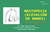 MASTOPEXIA CLINICA MURILLOPresentacion mastopexia web