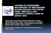 Locked in syndrome secondary a multiform glioblastoma in brain stem. ARTURO AYALA-ARCIPRESTE MD FAANS