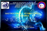 Gastrostomia, yeyunostomia, ileostomia