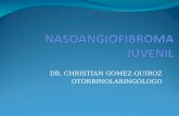 Nasoangiofibroma juvenil