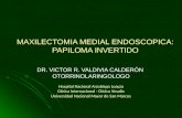 Maxilectomia endoscopica  papiloma invertido nasosinusal