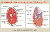 Presentation1.pptx, radiological anatomy of the thigh and leg.
