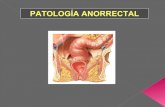 PatologíA Anorectal Y AtencióN Primaria
