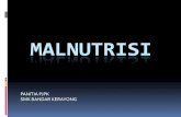 Malnutrisi f1