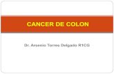 Cancer colo rectal