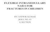 FLEXIBLE INTRAMEDULLARY NAILS FORFRACTURES IN CHILDREN