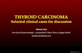 Carcinoma tiroideo - casi clinici
