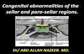 Presentation1.pptx, congenital abnormality of the sellar and para sellar regions